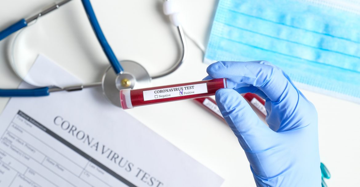 shutterstock/ coronavirus/ blood test